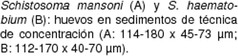 Schistosoma mansoni