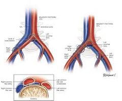 die Beckenarterie 

die Beckenvene