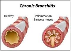 chronische Bronchitis