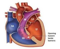 Vitium (cordis)