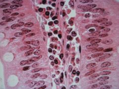 high magnification of ____ ____ tissue of lamina propria in the ____ ____. ___ ____ epithelium with goblet cells. ___ are adjacent to the epithelium. 