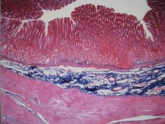 low magnification of the ___ wall. The trichrome stain illustrates the difference between collagen fibers in the ___ connective tissue and in dense irregular connective tissue. 