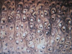 medium magnification of ___ cartilage in _____ ___. illustrating the appearance and distribution of ___ fibers in its matrix. With silver stain, the elastic fibers are visible in the ___ ___ matrix as thin, dark branching strands. The cells surrou...