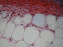 high magnification of connective tissue and ____ tissue. 