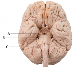 Identify the indicated parts of the brain stem