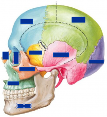 Lateral surface of the cranium:


 


-Frontal Bone


-Parietal Bone


-Occipital Bone


-Temporal Bone


-Sphenoid Bone


-Zygomatic Bone (with zygomatic arch)


-Lacriminal Bone


-Nasal Bone


-Maxilla Bone


-Mandible Bo...