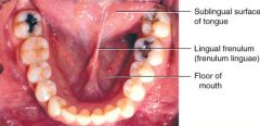 The vertical band of oral mucosa that attaches lips to the alveolar mucosa of the mandibular arch