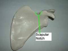 The top portion of the supra scapular notch is covered by the _______________ ligament. The suprascapular nerve, from the ____________ trunk of Brachial plexus is touching it.