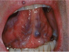 This is where the veins are more dialated, hence look blue underneath the tongue.