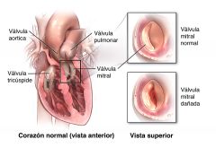 Válvula entre la aurícula izquierda y el ventrículo izquierdo.