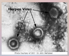 54. Hepes – Herpesviruses – [DNA] virus.