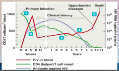 58. HIV – Human Immunodeficient Virus – RNA Virus.

AIDS is not a disease, but a [SYNDROME] – certain opportunistic or rare infections that occur in the presence of antibodies against HIV and CD4 [WHITE] blood cell count below 200 cells/mic...