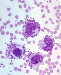 CAN BE VERY DIFFICULT
- amastigotes in tissue biopsies and cytologic preps (look identical to histoplasmosis and trypomaniasis but leishmania amastigotes are only found in macrophages)- ELISA
- IFA
-PCR