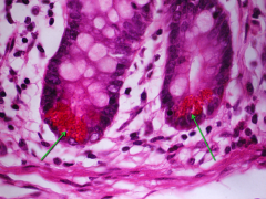 Células de Paneth en cualquier sitio del intestino delgado