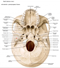 Bones = within the temporal bone (between the tympanic and petrous portions) 


 


Connects the tympanic cavity (within the temporal bone) and infratemporal fossa 


 


Chorda Tympani  artery goes through it