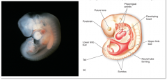44. Organogenesis (4th week after fertilization)

________ period of development (fetal _______ syndrome).