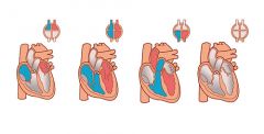 Incluye todos los hechos que se producen entre dos latidos cardiacos consecutivos. 

	
		
		
	
	
		
			
				
					Todas las cámaras del corazón pasan por una fase de relajación (diástole) y
una fase de contracción (sístole)...
