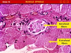 MUSCLE SPINDLE

Notice the difference in diameters between the intrafusal skeletal muscle fibers (I.e. those within the muscle spindle) compared to the much larger extrafusal fibers.
