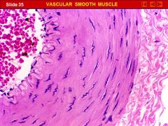 Notice the “cork screw” appearance of the smooth muscle nuclei.  This is seen if the muscle cells are fixed in a contracted state.  It will not be seen if the cells are elongated or stretched.