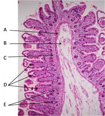 (D) Vellosidades intestinales(C) Lámina propia
(E) Glándulas intestinales
(A) Muscular de la mucosa
(B) Submucosa    
