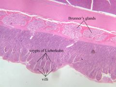Vellosidades con microvellosidades que son más gordas y chaticas en el duodeno, pliegues menos definidos.Criptas de Lieberkuhn (glándulas tubulares ramificadas o simples) con células
Muscular de la mucosa

