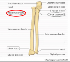 So, as established, biceps brachii is responsible for flexion & supination. 

Biceps brachii Inserts on the Radial or Ulnar Tuberosity?