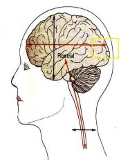 In a biped above the diencephalic flexure, this the the term meaning towards the back of the skull.