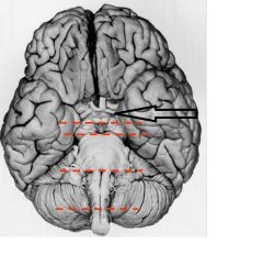 Name this major subdivision of the brain which includes the thalamus and hypothalamus.  