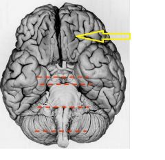 Name this major subdivision of the brain which includes the cerebral cortex and subcortical nuclei. 