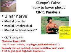 Inferior brachial plexus nerve injury!
