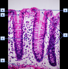  ( A ) Epitelio superficial( F ) Glándula intestinal o cripta de Lieberkühn
( C ) Tejido conectivo de la lámina propia
( D ) Muscular de la mucosa
( B ) Célula caliciforme
( E ) Enterocito  