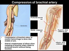 note: location of how subclavian artery transitions from axilla--> brachial--> once it passes teres major