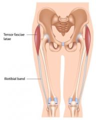 - thickened fascia that extends distally from tensor fascia latae to Gerdy's Tubercle


 


- gives the lateral aspect of the knee increased stability