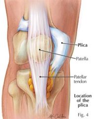 - remnants of embryonic tissue that appears in the knee as folds in the joint lining


 


- usually thin, elastic, pliable tissues


 


- can become thickened areas of scar tissue .... therefore inelastic with repetitive stress