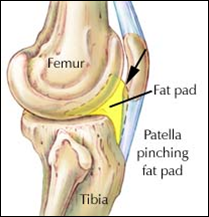 - from the lower pole of the patella to the tibia, posterior to the patellar tendon


 


- shock absorber & nutrition source for the tendon