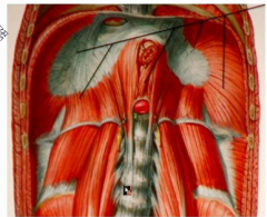 what two muscles go through the diaphragm here?