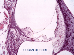 Where is the Organ of Corti located?