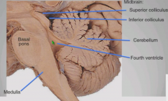 Open portion which borders fourth ventricle
Closed portion unconnected to ventricles