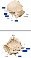 Temporal Bone :


 


-articular tubercle


-mandibular fossa


-mastoid process


-internal acoustic meatus


-zygomatic process


 


-petrous portion 


-squamous portion 