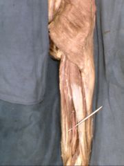 Shown here is the Popliteal Vein.

These ______________ & _____________ veins come together near the popliteal fossa and form the origin of the popliteal vein in the popliteal fossa.