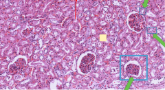 This is a section of a Kidney tissue. List what the three arrows are pointing to 