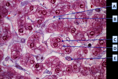 A) Espacio de DisseB) Sinusoide
C) Hepatocito
D) Canalículo biliar
E) Célula de Kupffer (macrófago)