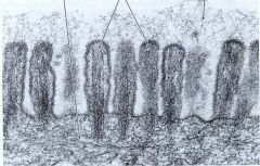 Micrivilli. 
 Microvilli are actin microfilaments