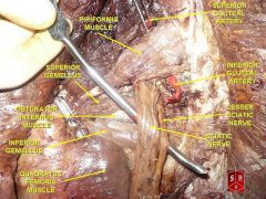 piriformis s labeled. I find it easiest to look for sciatic nerve & then look for muscle above which the sciatic nerve juts out. 

What vein, nerve, arteries are above the piriformis muscle & pass through the greater sciatic foramen