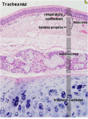 a very thick layer that underlies the epithelium