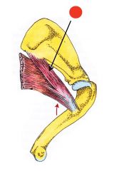 Medial view