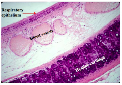 slide of the trachea
