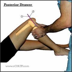 tests stability of the PCL 
1. position the patient and place hands the same way as anterior drawer 
2. push the tibia posteriorly and observe the degree of backward movement in the femur 
 
isolated PCL tears are rare