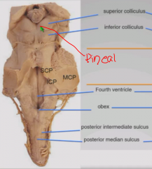 Midline groove
On either side is sulcus limitans
Rhomboid shaped fourth ventricle, bottom is called obex.
Middle cerebellar peduncle connecting cerebellum to pons