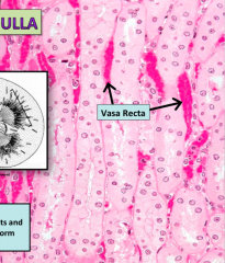 A section of the Renal medulla, see if you can spot the 4 things (including vasa recta) found in medulla